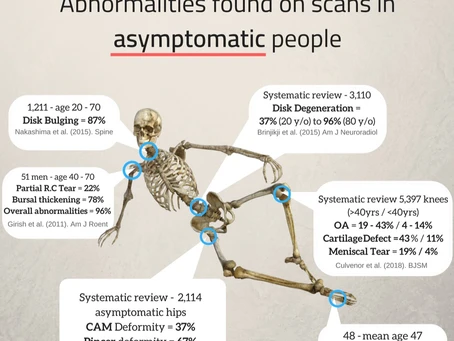 Skeletons found on scans of asymptotic people.
